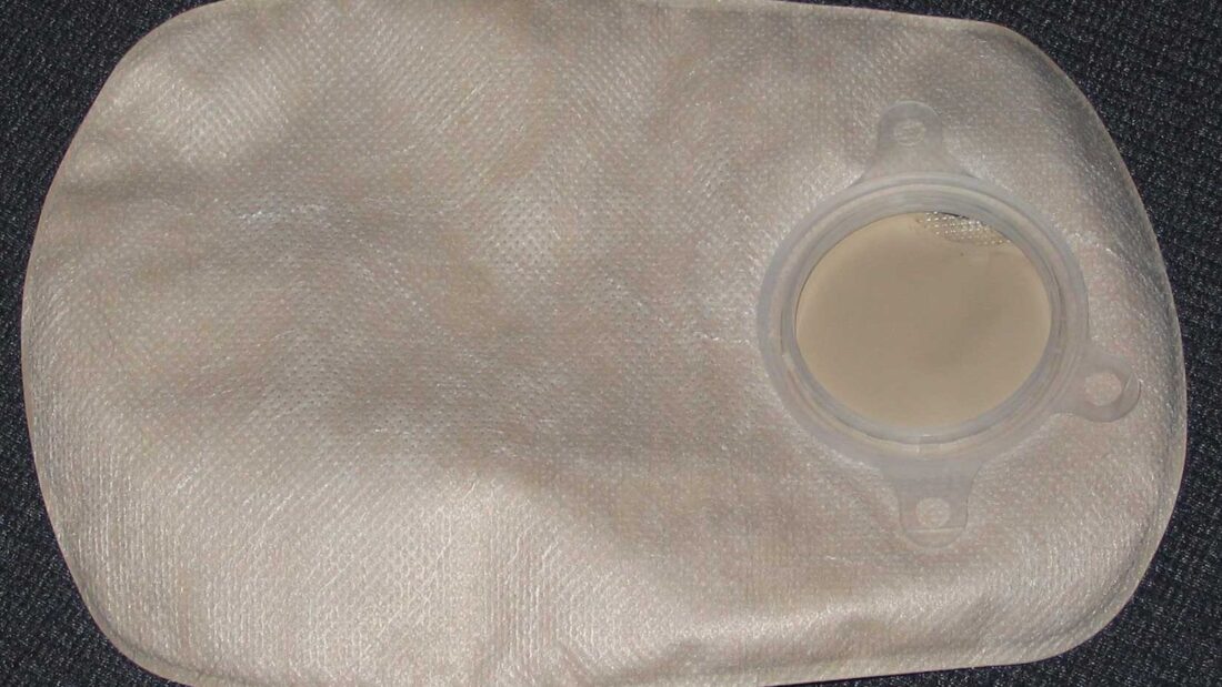 Bolsa de colostomia de duas peças, de cor bege, com o anel de encaixe transparente, sobre fundo escuro