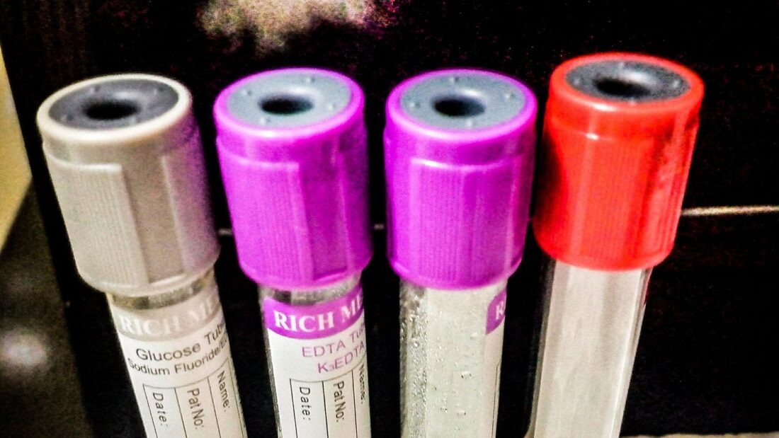 Quatro tubos de coleta de sangue com tampas cinza, roxas e vermelha em um suporte de laboratório