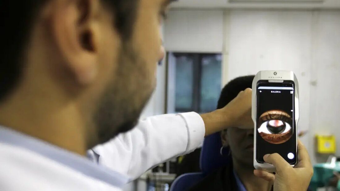 Médico segura retinógrafo portátil acoplado a um celular diante do olho de um paciente; a tela mostra a imagem ampliada do olho